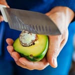 Understanding Nerve Injuries: Symptoms, Treatments, and Recovery Options for Hands and Wrists Nerve injury after cutting an avocado with a knife